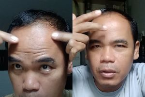 Tak perlu skincare mahal, ini cara mudah hilangkan kerutan di wajah pakai kolagen booster Rp12 ribuan