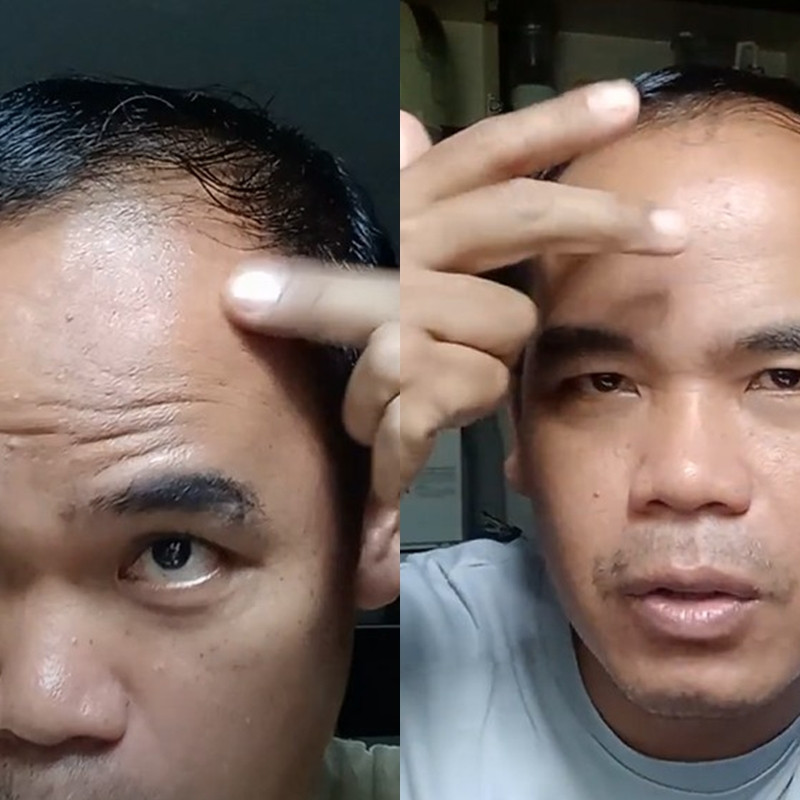 Tak perlu skincare mahal, ini cara mudah hilangkan kerutan di wajah pakai kolagen booster Rp12 ribuan