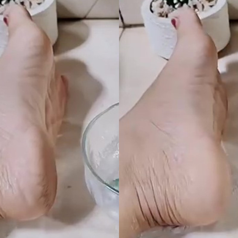 Tak perlu direndam air hangat, begini cara bikin tumit pecah-pecah jadi mulus cuma dengan 2 tanaman