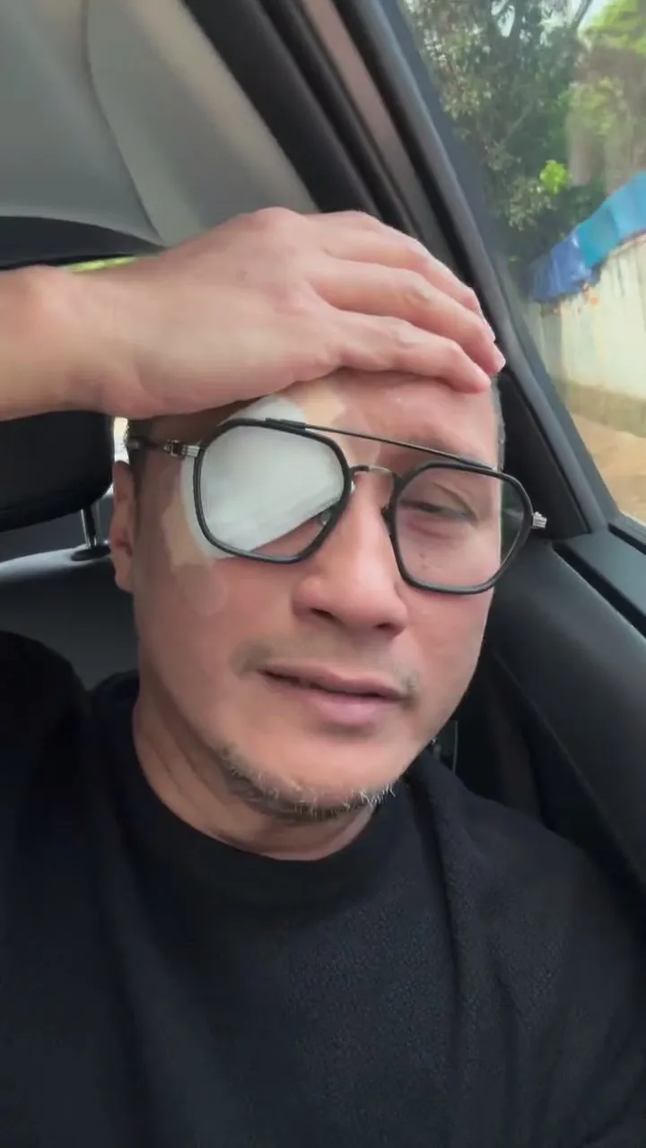 Mata kena lemparan bola saat main padel, begini kondisi Arie Untung usai dilarikan ke rumah sakit