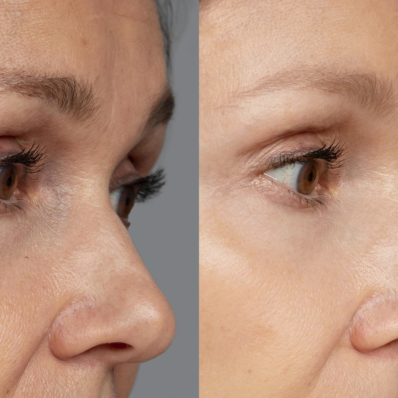 Buah satu ini bisa jadi masker kolagen untuk atasi garis halus di wajah, begini cara pakainya