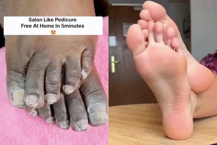 Modal 1 jenis rempah, begini cara mengatasi tumit hitam dan kasar agar mulus lagi bak perawatan salon