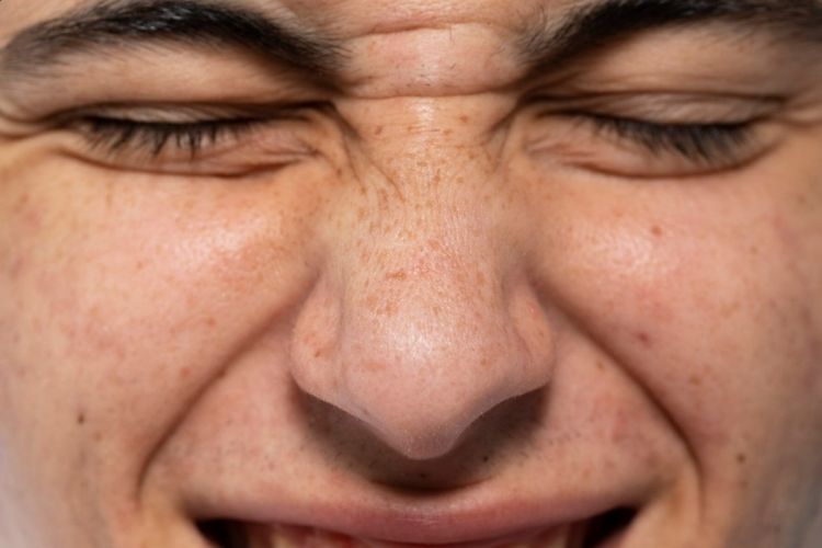 Tak perlu repot pakai masker, ini cara baru mengecilkan pori-pori dengan face mist dari 2 bahan dapur