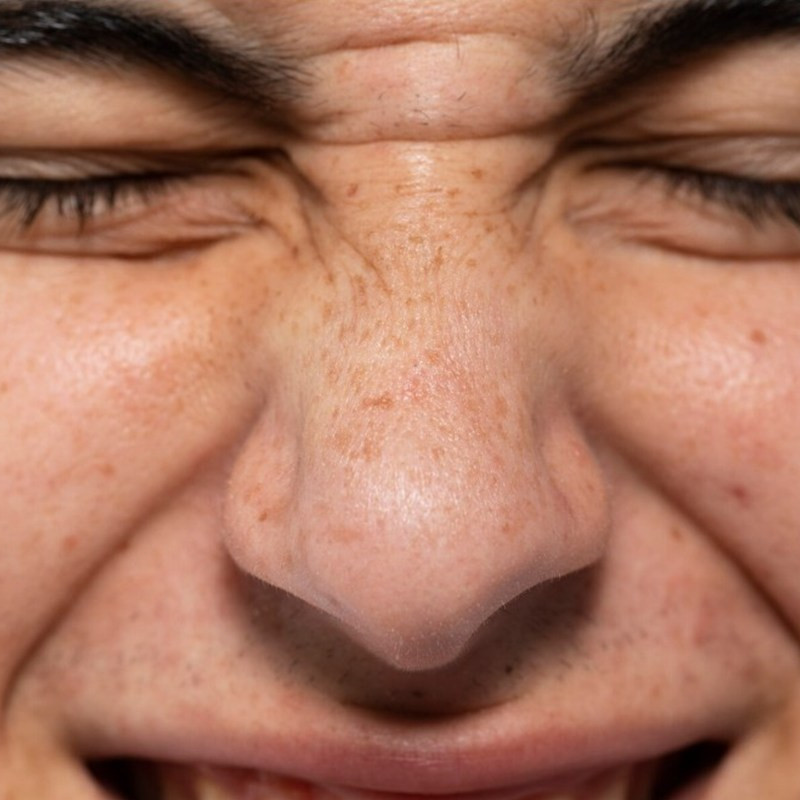 Tak perlu repot pakai masker, ini cara baru mengecilkan pori-pori dengan face mist dari 2 bahan dapur