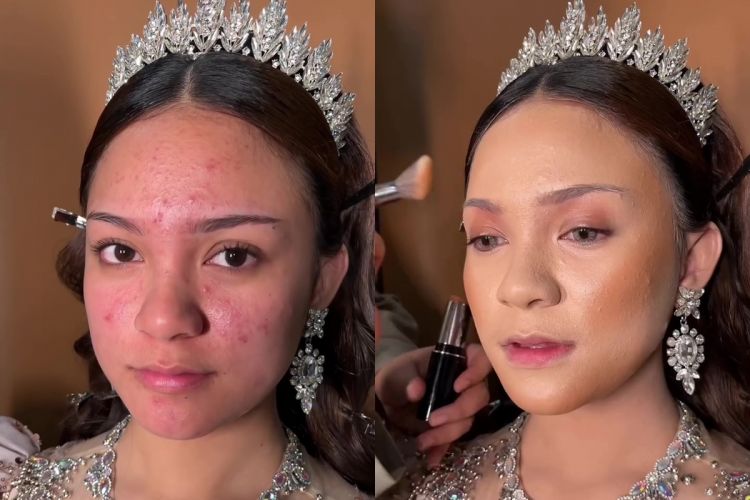 Punya jerawat aktif, transformasi wanita usai di-makeup ini bikin tampilannya berubah 180 derajat