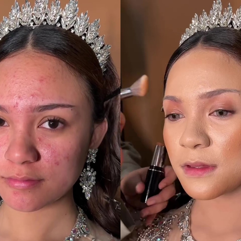Punya jerawat aktif, transformasi wanita usai di-makeup ini bikin tampilannya berubah 180 derajat