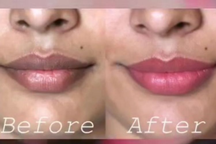 Bibir gelap dan kering bikin nggak nyaman? Coba scrub dari 3 bahan dapur ini agar jadi pink alami