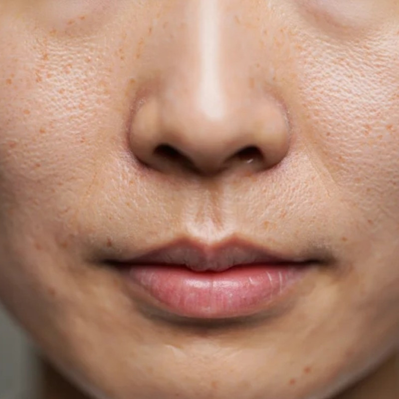 Tak perlu treatment mahal, rutin lakukan perawatan rumahan ini bisa bikin wajah mulus bebas pori-pori