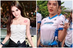 9 Potret Icha Chellow artis viral sound horeg sebelum oplas, perubahan hidungnya bikin pangling