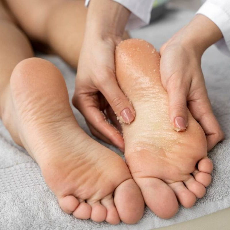 Bukan lotion, ini cara jitu hilangkan tumit pecah-pecah agar lebih mulus dan sehat bak kulit remaja