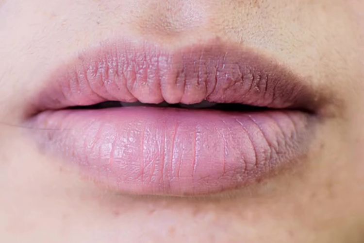 Ingin punya bibir lembap dan pink alami? Ini cara mendapatkannya pakai scrub dari bahan alami