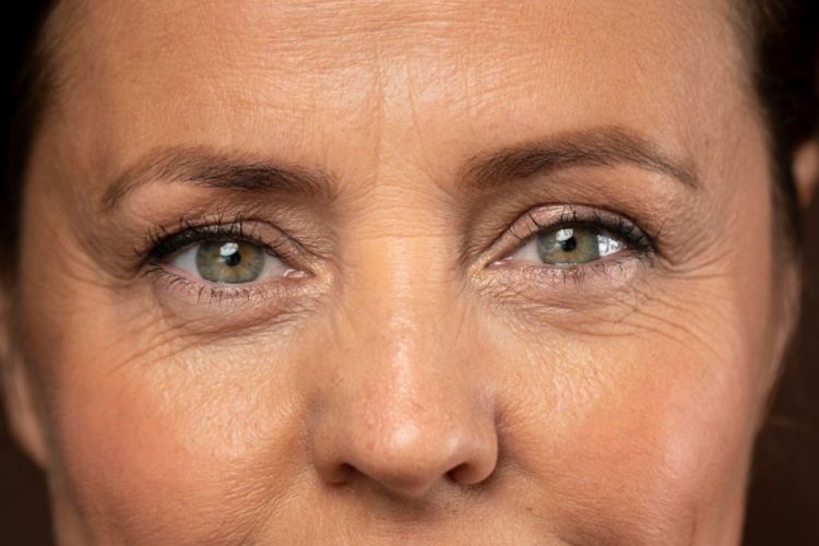 Rahasia menghilangkan keriput di bawah mata ini praktis cuma butuh eye patch dari 2 jenis tanaman