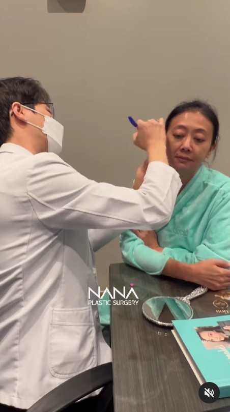 Alasan Asri Welas rogoh kocek Rp500 juta untuk oplas wajah dan tubuh, sebut demi kepentingan kerja