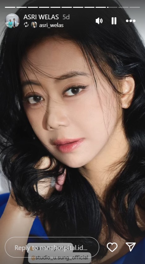 Alasan Asri Welas rogoh kocek Rp500 juta untuk oplas wajah dan tubuh, sebut demi kepentingan kerja