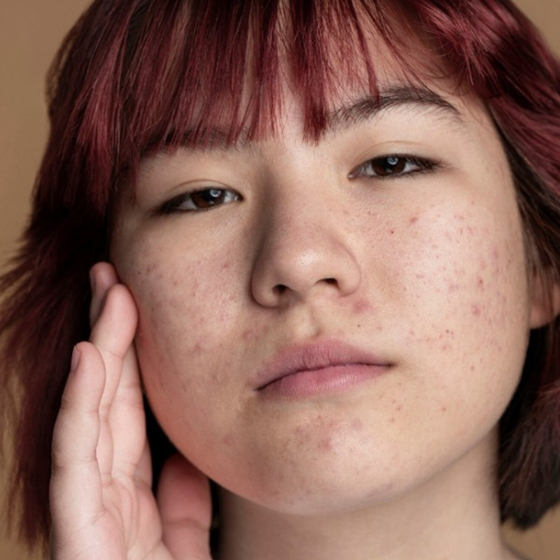 Bukan retinol, cara jitu eksfoliasi wajah ini bikin mulus dan pori-pori bersih pakai 2 bahan dapur