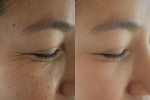 Trik kembalikan kekenyalan wajah pakai 1 bahan makanan, auto awet muda tanpa keluar duit banyak