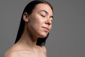 10 Serum untuk wajah berjerawat harga di bawah Rp 200 ribu