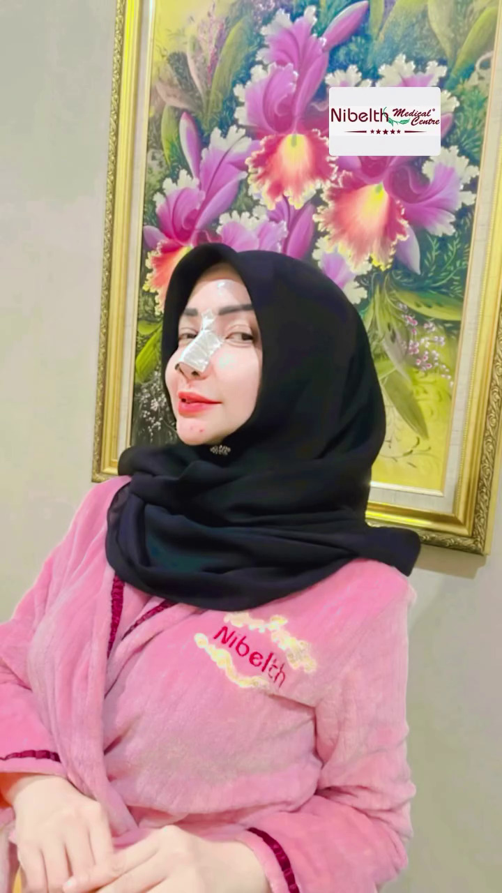 7 Potret Roro Fitria jalani operasi plastik hidung, ngaku demi kesehatan