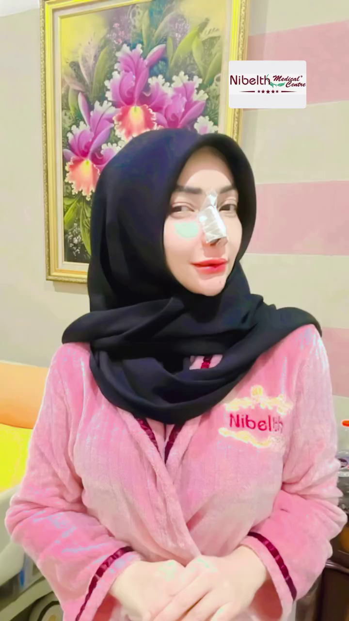 7 Potret Roro Fitria jalani operasi plastik hidung, ngaku demi kesehatan