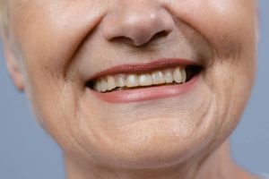 Sebel sama garis halus di dekat bibir? Ini trik menghilangkannya cuma pakai 2 produk