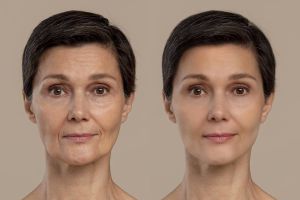 Bukan pakai masker dari beras, ini cara hilangkan kerutan dan kulit kendur pakai 1 jenis sayuran