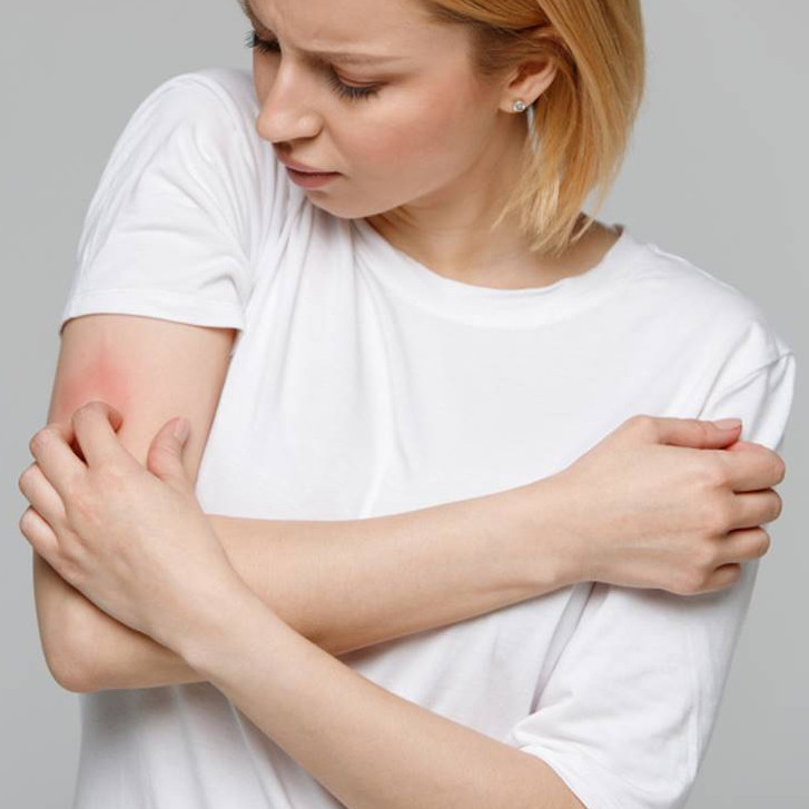 Cara alami mengatasi gatal-gatal biasa hingga menahun pada kulit cuma pakai 3 bahan dapur