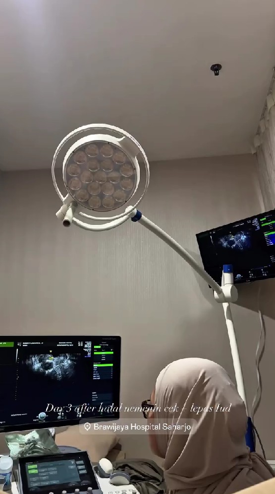 9 Potret Clara Shinta putuskan lepas KB usai kembali sandang status istri, bahagia ditemani suami