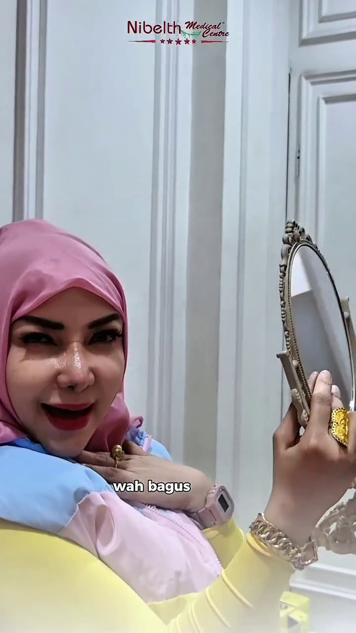 9 Potret terbaru Roro Fitria usai operasi plastik bagian hidung, dipuji makin cantik