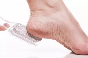 Kaki mulus dalam 10 menit, ini rahasia atasi tumit pecah-pecah dan dekil pakai 1 bahan herbal saja