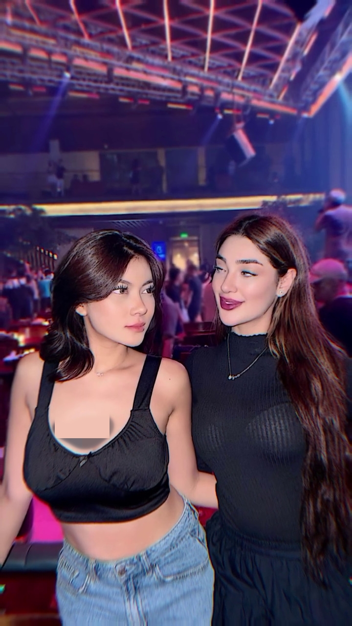 Jalani oplas bagian hidung, 9 potret terbaru Hanum Mega banjir pujian karena hasilnya tampak natural