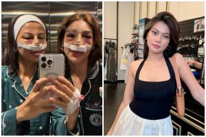 Jalani oplas bagian hidung, 9 potret terbaru Hanum Mega banjir pujian karena hasilnya tampak natural