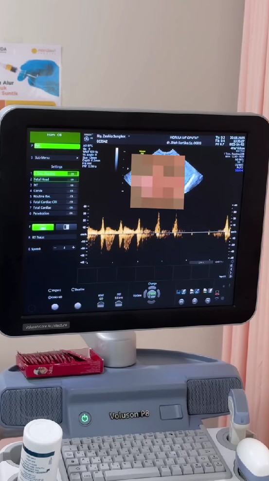 Zaskia Sungkar umumkan kehamilan kedua, ini 9 potret bahagianya saat jalani USG