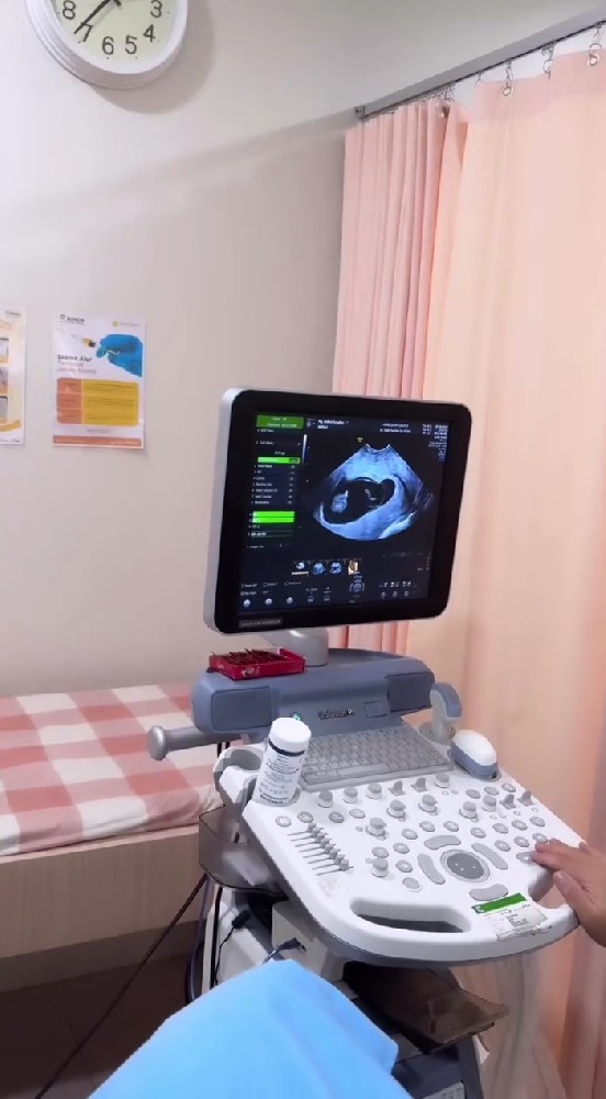 Zaskia Sungkar umumkan kehamilan kedua, ini 9 potret bahagianya saat jalani USG