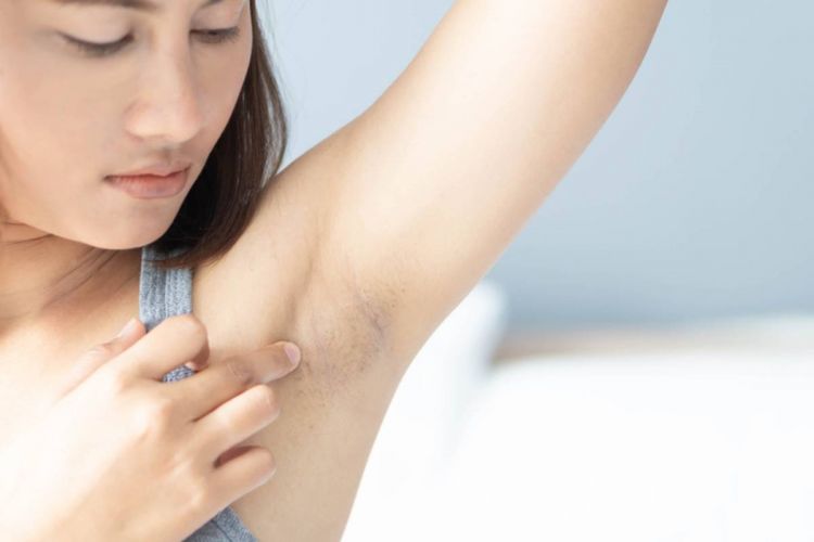 Trik wanita atasi ketiak hitam dan bau nggak enak cuma andalkan 1 bahan masak, auto pede lagi