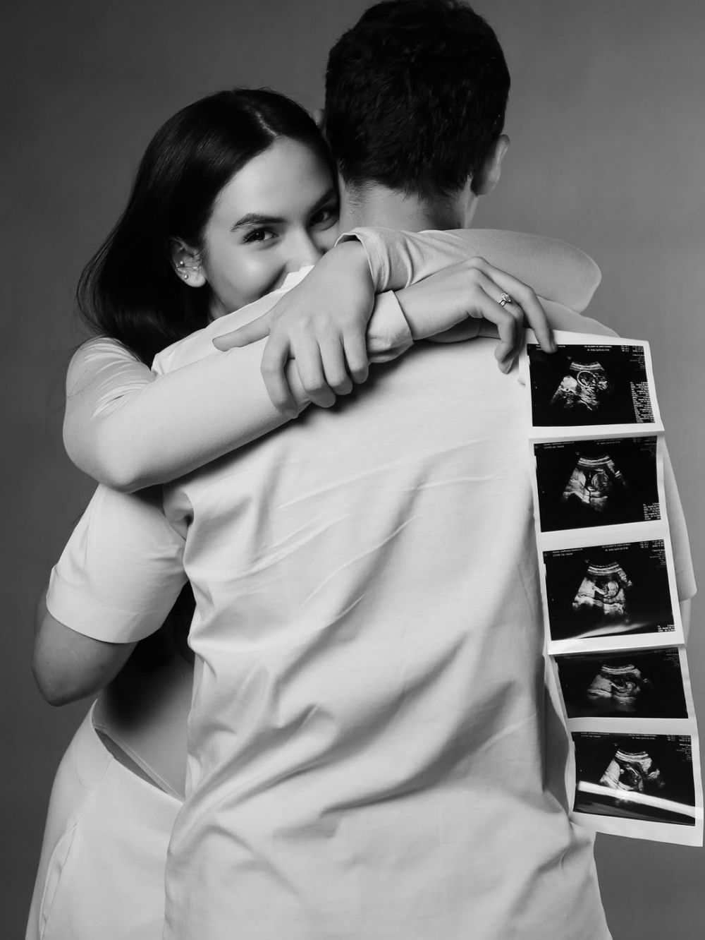 9 Potret Nino Fernandez dan Steffi Zamora umumkan kehamilan anak pertama, sudah pamer baby bump