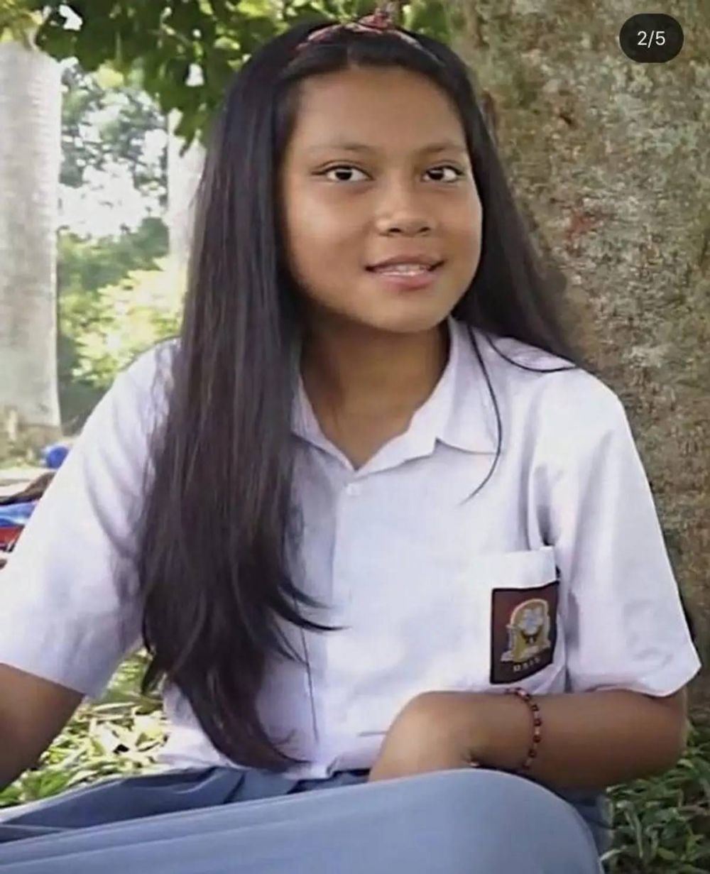 Makin memesona usai operasi hidung, ini 9 potret transformasi Hanum Mega yang berubah 180 derajat