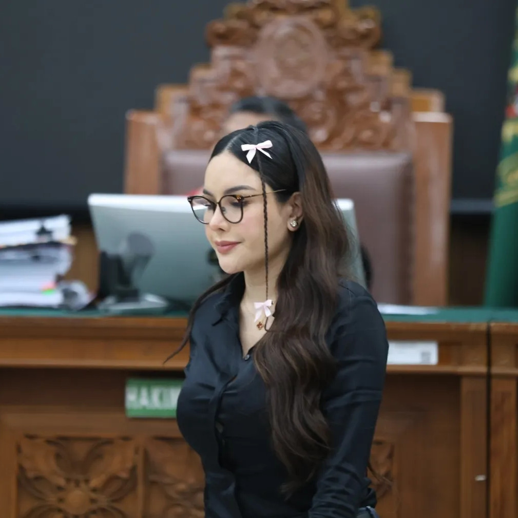 Curhat Nikita Mirzani harus jalani fisioterapi 6 pekan, gegara tidur di penjara sebabkan leher sakit