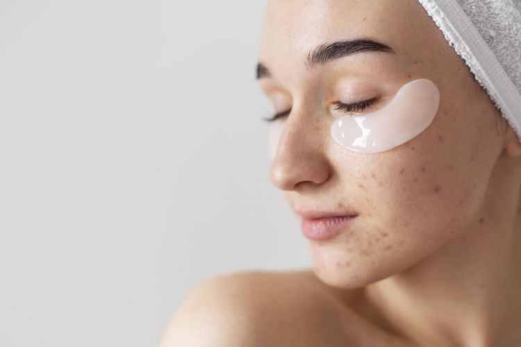 8 Krim menghilangkan fungal acne, wajah bersih dari jerawat membandel
