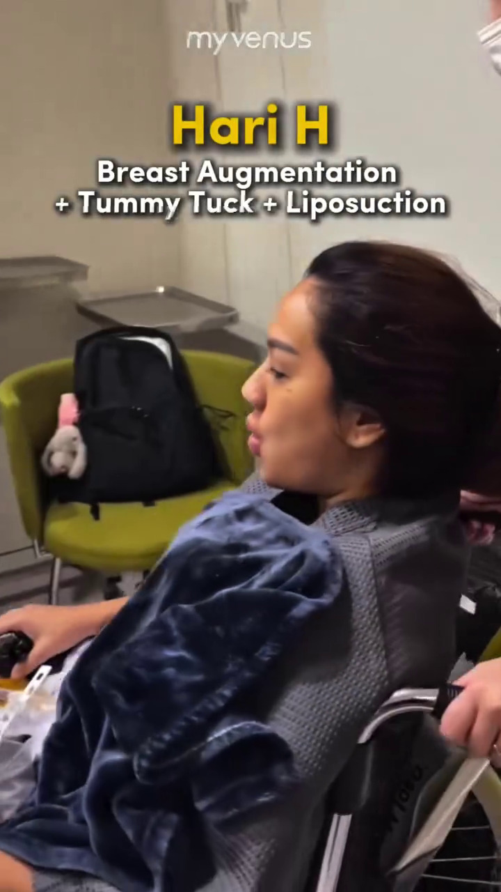 9 Potret Tengku Dewi jalani operasi estetika tubuh di Korea, habiskan ratusan juta, kini kian singset