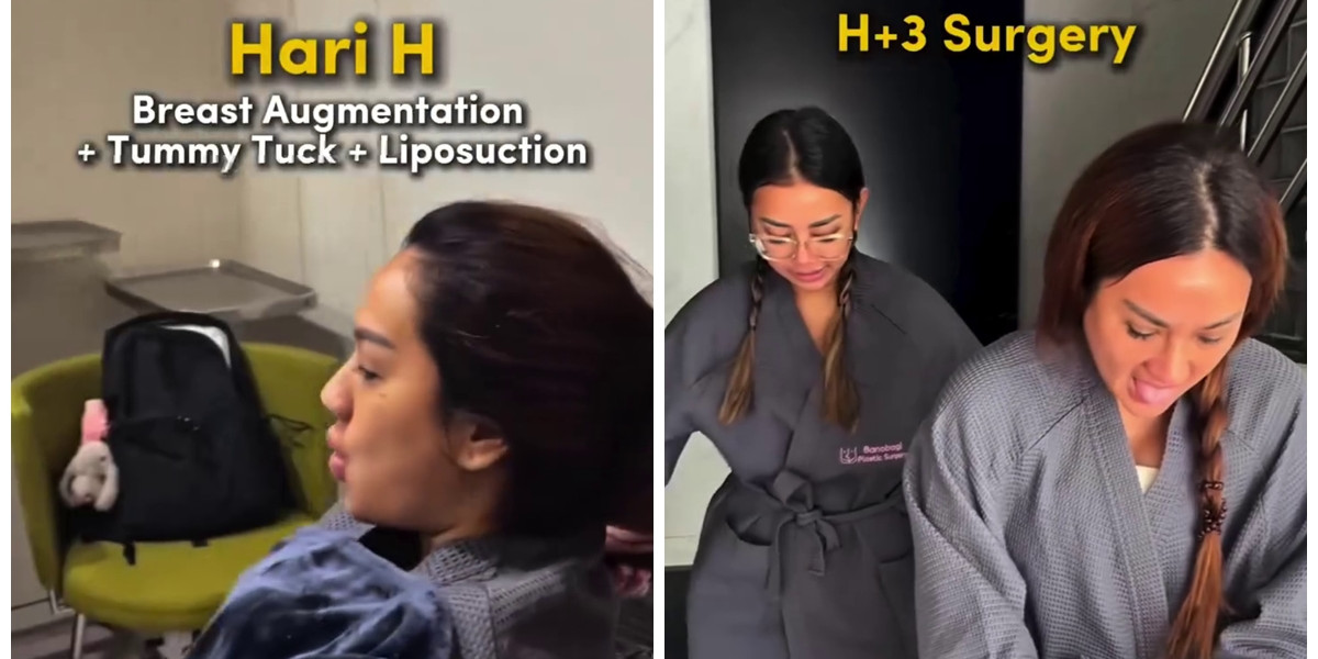 9 Potret Tengku Dewi jalani operasi estetika tubuh di Korea, habiskan ratusan juta, kini kian singset