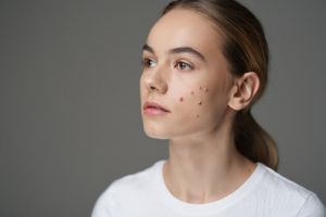 7 Concealer harga di bawah Rp100 ribu, ampuh tutupi jerawat dan bekasnya tanpa bikin makeup cakey