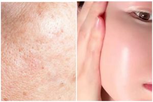  Cara bikin pori-pori jadi kecil ini hasilnya wajah auto mulus, andalkan serum dan 1 ampas dapur