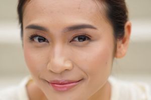 5 Cara mengurangi smile line tanpa operasi, aman dan efektif