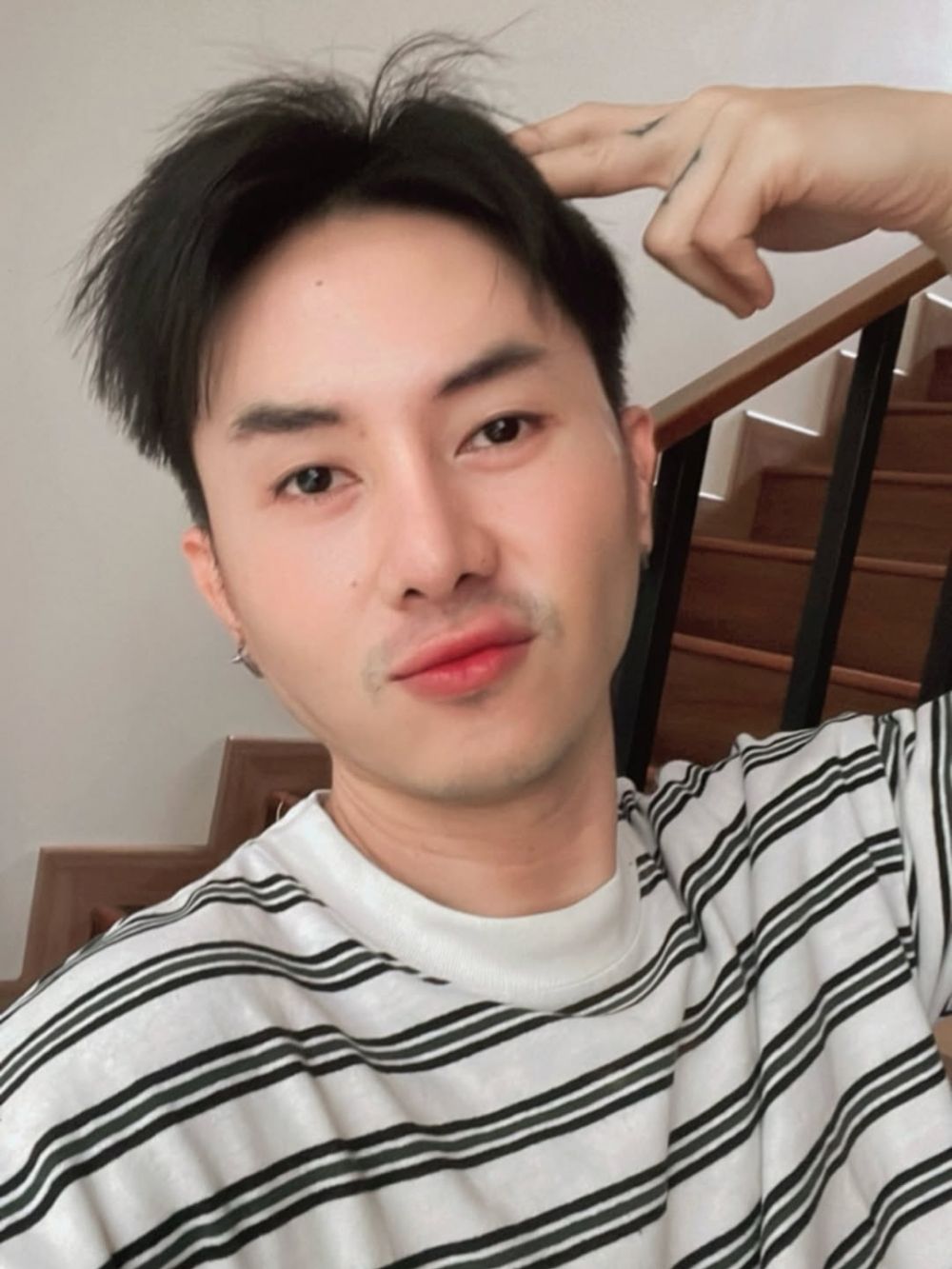 Ternyata bukan sekadar untuk estetika, ini 9 potret Rafael Tan usai oplas karena alami masalah mata