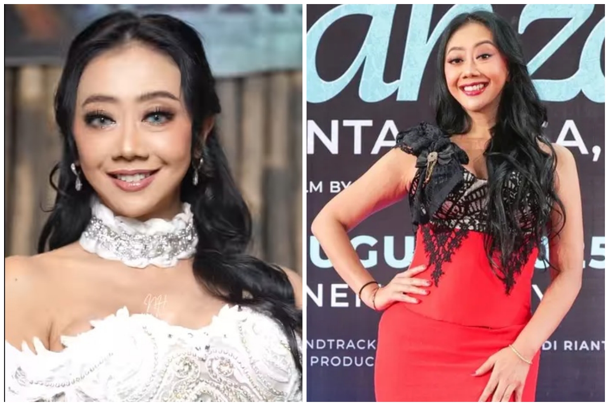 Tak malu akui oplas, Asri welas bagikan potret sebelum dan sesudah operasi anti-aging, dipuji natural