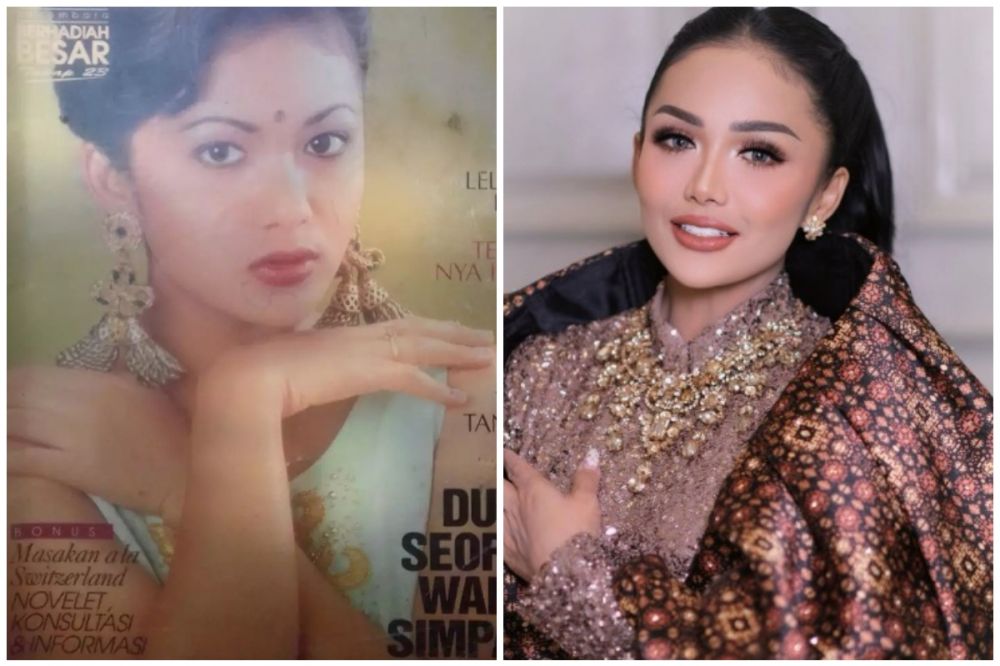 Bukti wajah awet muda itu butuh duit, 7 potret seleb usia 50-an sebelum dan sesudah operasi plastik