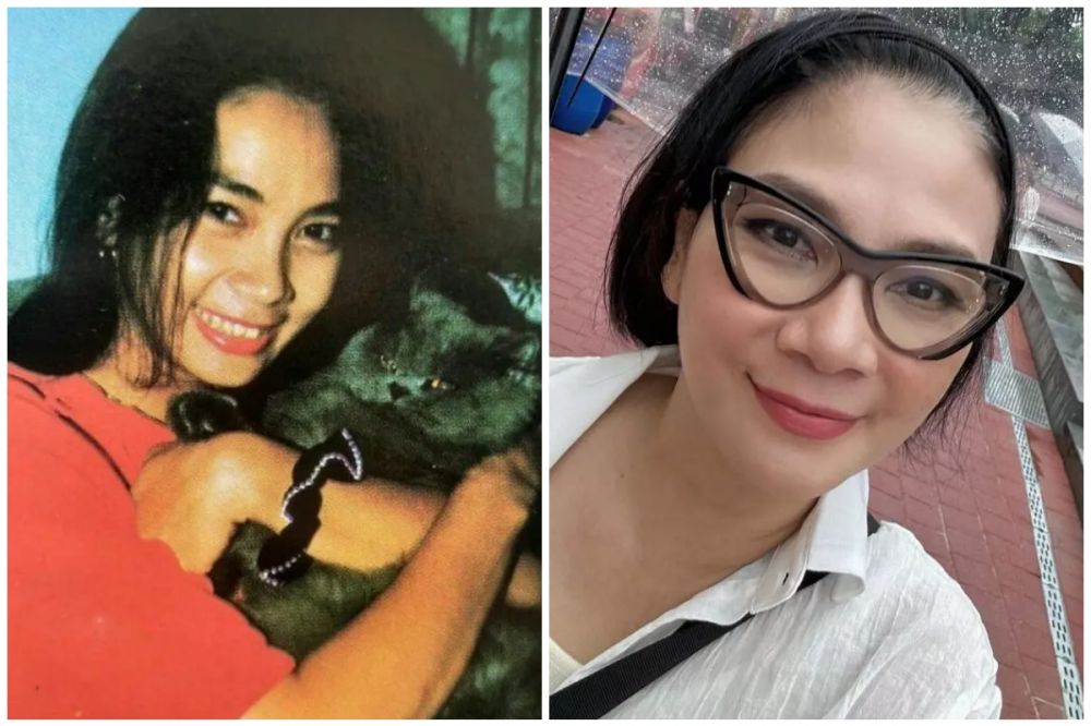 Bukti wajah awet muda itu butuh duit, 7 potret seleb usia 50-an sebelum dan sesudah operasi plastik