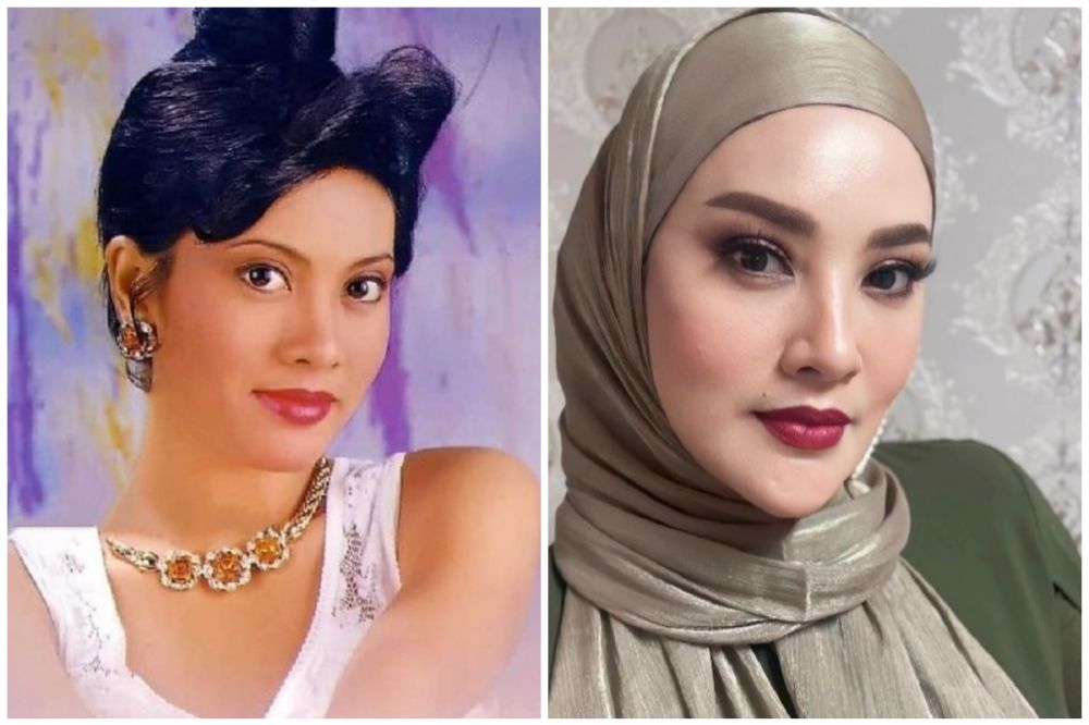 Bukti wajah awet muda itu butuh duit, 7 potret seleb usia 50-an sebelum dan sesudah operasi plastik