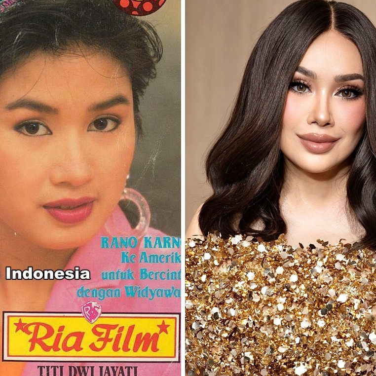 Bukti wajah awet muda itu butuh duit, 7 potret seleb usia 50-an sebelum dan sesudah operasi plastik