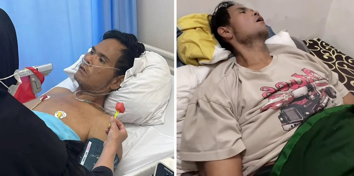 Kondisi Fahmi Bo kian memilukan, kaki mengecil hingga lumpuh total selama 4 bulan